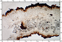 Genea sphaerica